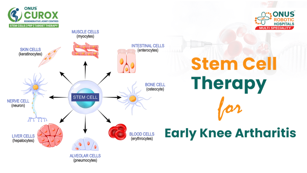 Stem Cell Therapy For Early Knee Artharitis