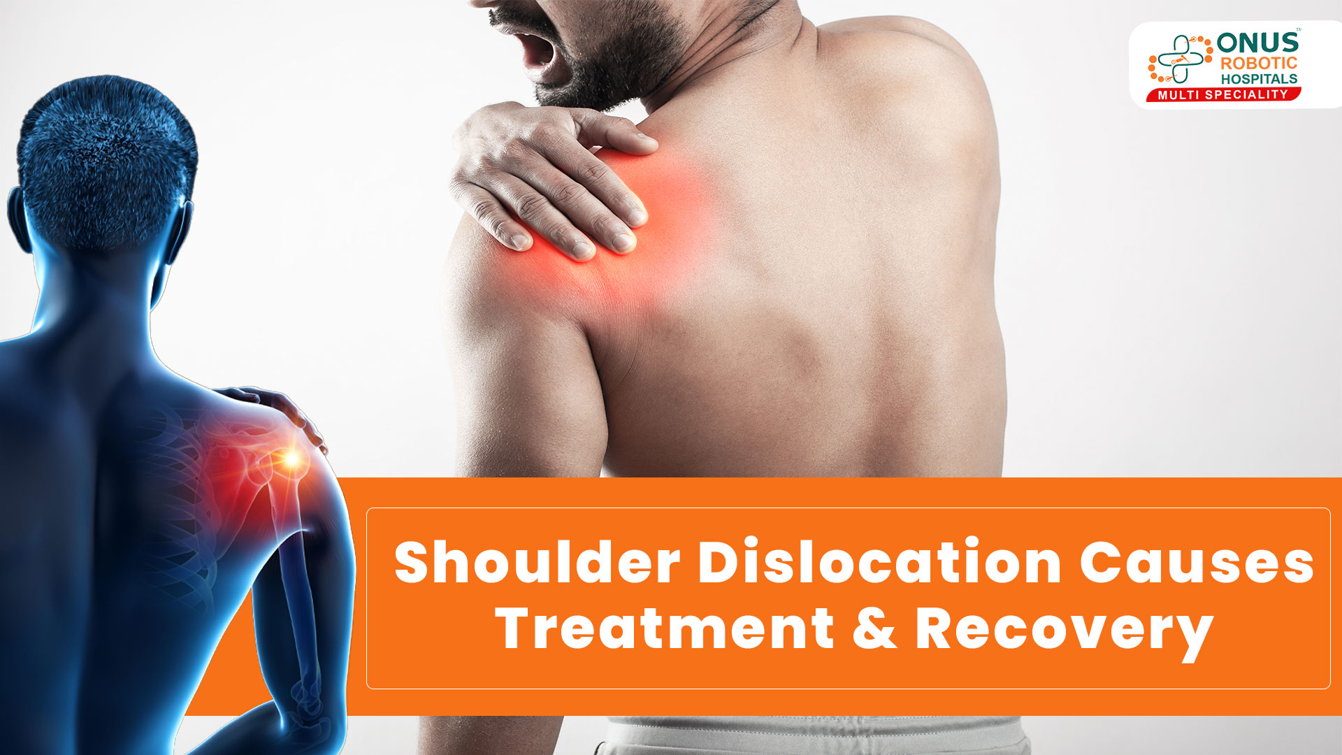 Shoulder Dislocation: Causes, Treatment & Recovery: Dr. Balaraju Naidu, Robotic Orthopedic Surgeon, ONUS ROBOTIC HOSPITALS