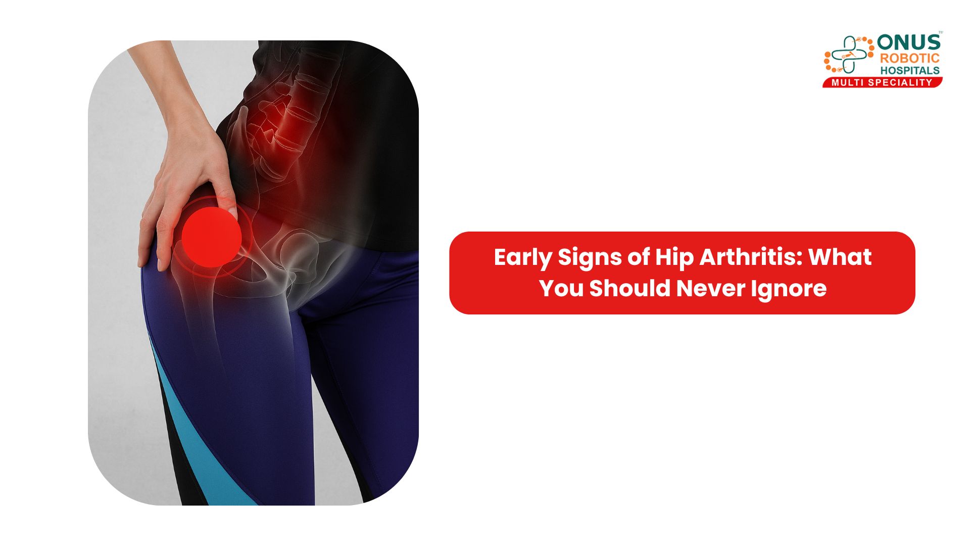 Early Signs of Hip Arthritis: What You Should Never Ignore: By Dr. Balaraju Naidu, Robotic Orthopedic Surgeon, ONUS Robotic Hospitals