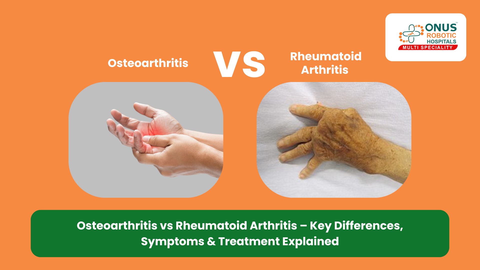 Osteoarthritis vs Rheumatoid Arthritis – Key Differences, Symptoms & Treatment Explained: By Dr. Balaraju Naidu, Robotic Orthopedic Surgeon, ONUS Robotic Hospitals