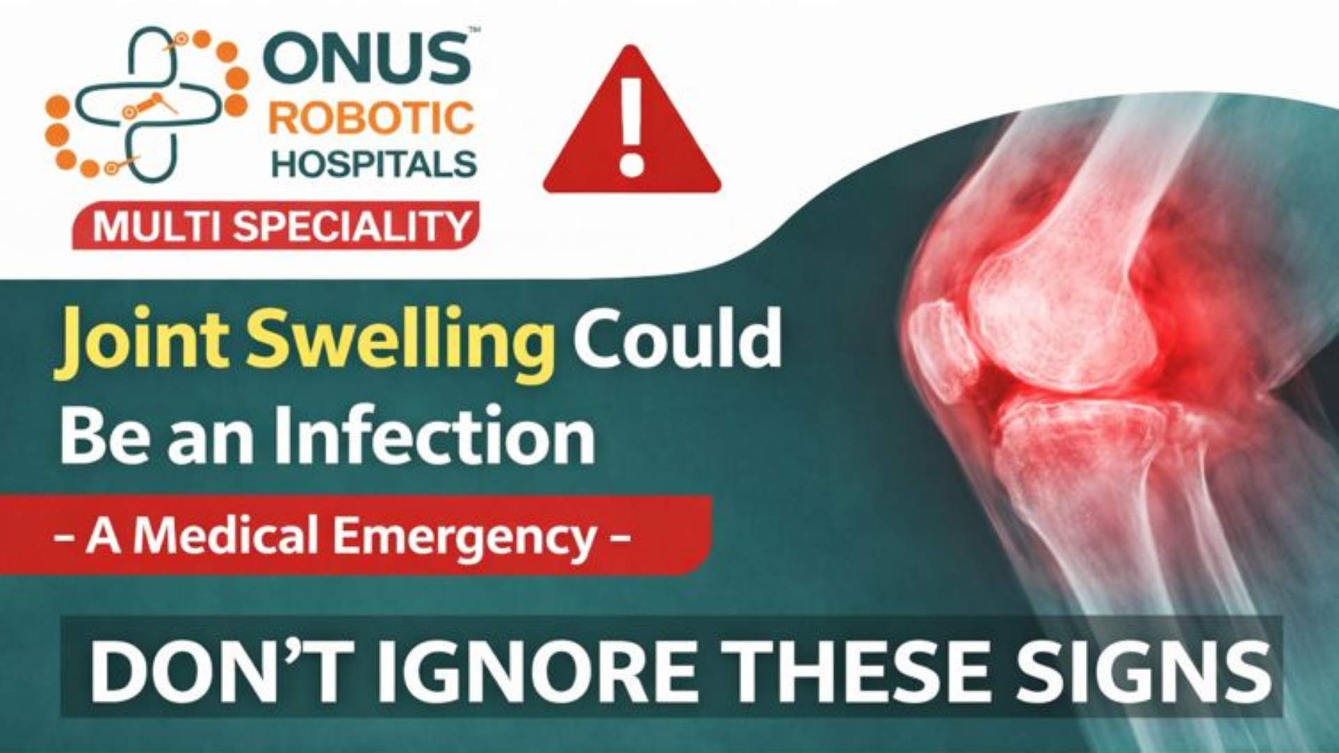 When Joint Swelling Means Infection: A Medical Emergency You Shouldn’t Ignore- By Dr. Balaraju Naidu, Robotic Orthopedic Surgeon, ONUS Robotic Hospitals
