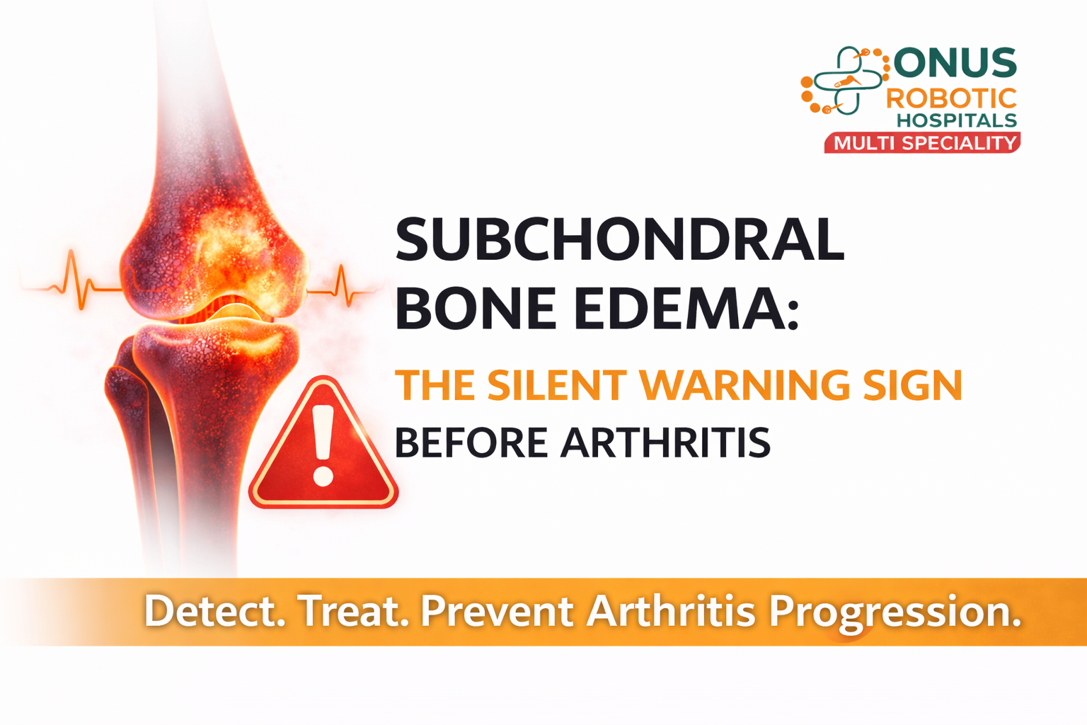 Subchondral Bone Edema: The Silent Warning Sign Before Arthritis: By Dr. Balaraju Naidu, Robotic Orthopedic Surgeon, ONUS Robotic Hospitals