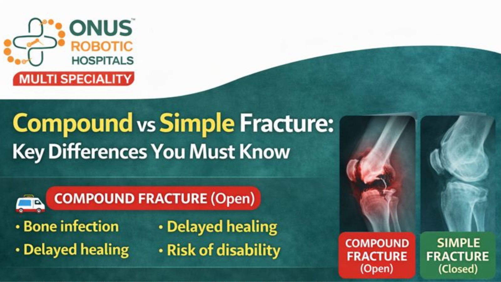 Compound vs Simple Fracture: Key Differences You Must Know: By Dr. Balaraju Naidu, Robotic Orthopedic Surgeon, ONUS Robotic Hospitals