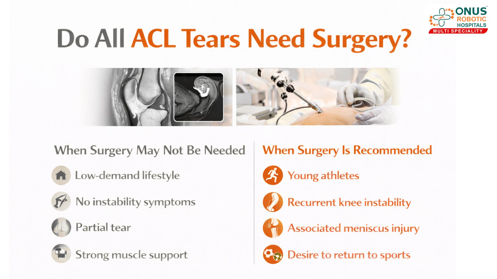 Do All ACL Tears Need Surgery? Understanding Treatment Options for ACL Injuries – By Dr. Balaraju Naidu, Robotic Orthopedic Surgeon, ONUS Robotic Hospitals