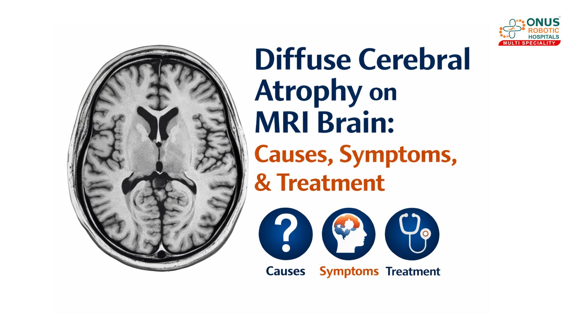 Diffuse Cerebral Atrophy on MRI Brain: Causes, Symptoms, and Treatment – By Dr.Krishna Chaithanya Reddy, Neurologist, ONUS Robotic Hospitals