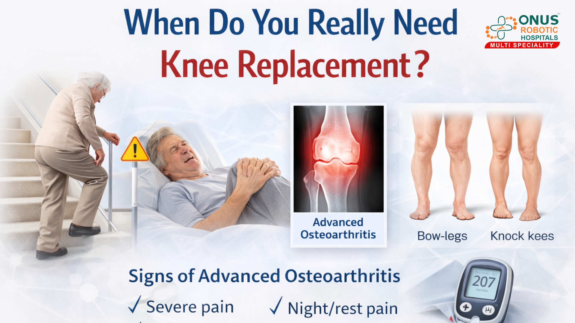 When Do You Really Need Knee Replacement? – By Dr. Balaraju Naidu, Robotic Orthopedic Surgeon, ONUS Robotic Hospitals