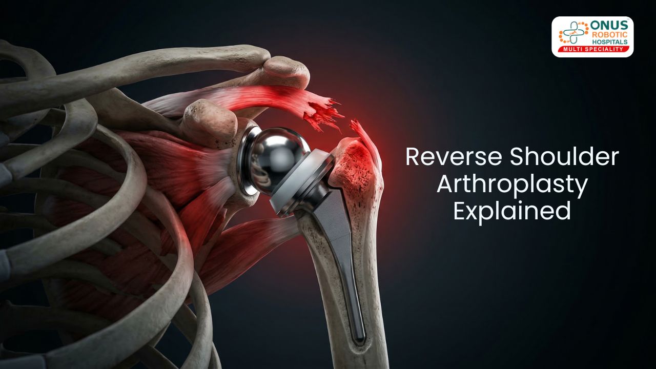 Understanding Reverse Shoulder Arthroplasty – A Modern Solution for Advanced Shoulder Damage – By Dr. Balaraju Naidu, Robotic Orthopedic Surgeon, ONUS Robotic Hospitals