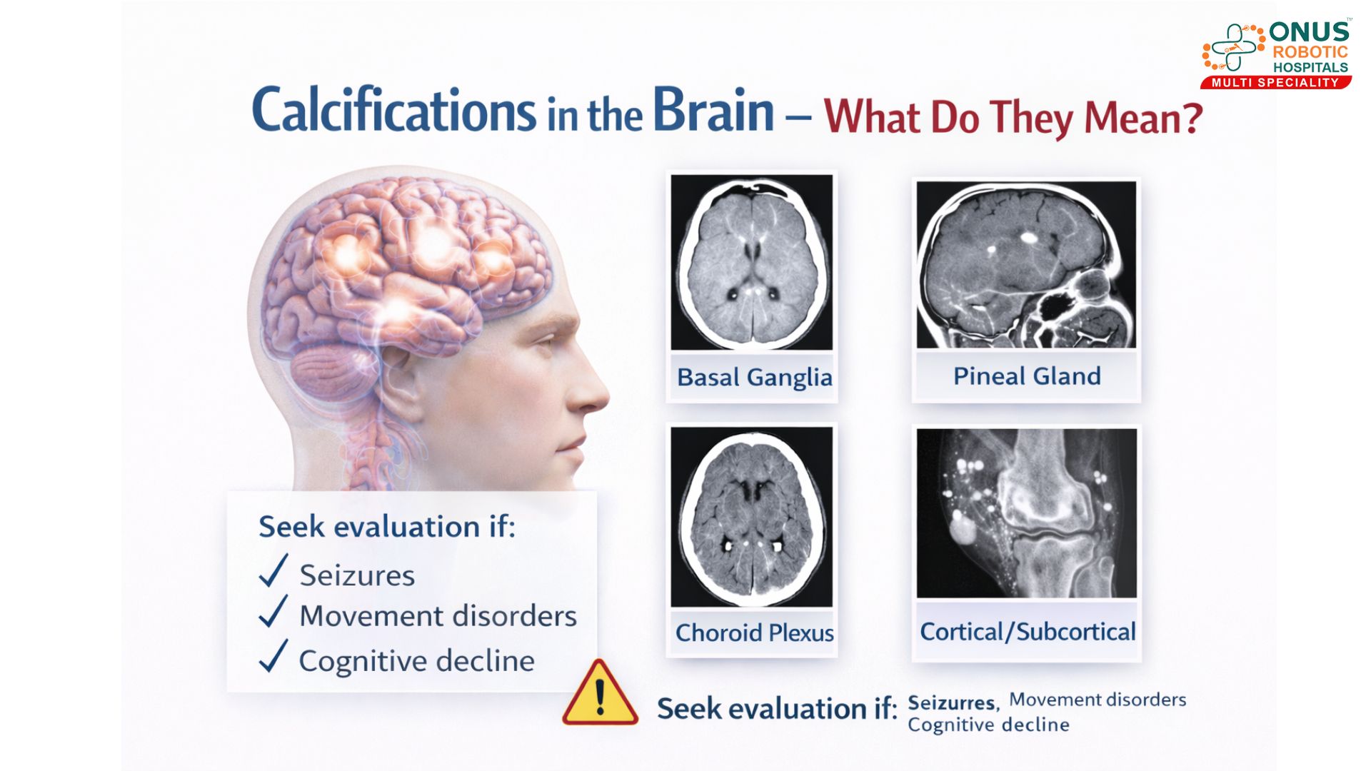 Calcifications in the Brain – What Do They Mean? – By Dr.Krishna Chaithanya Reddy, Neurologist, ONUS Robotic Hospitals