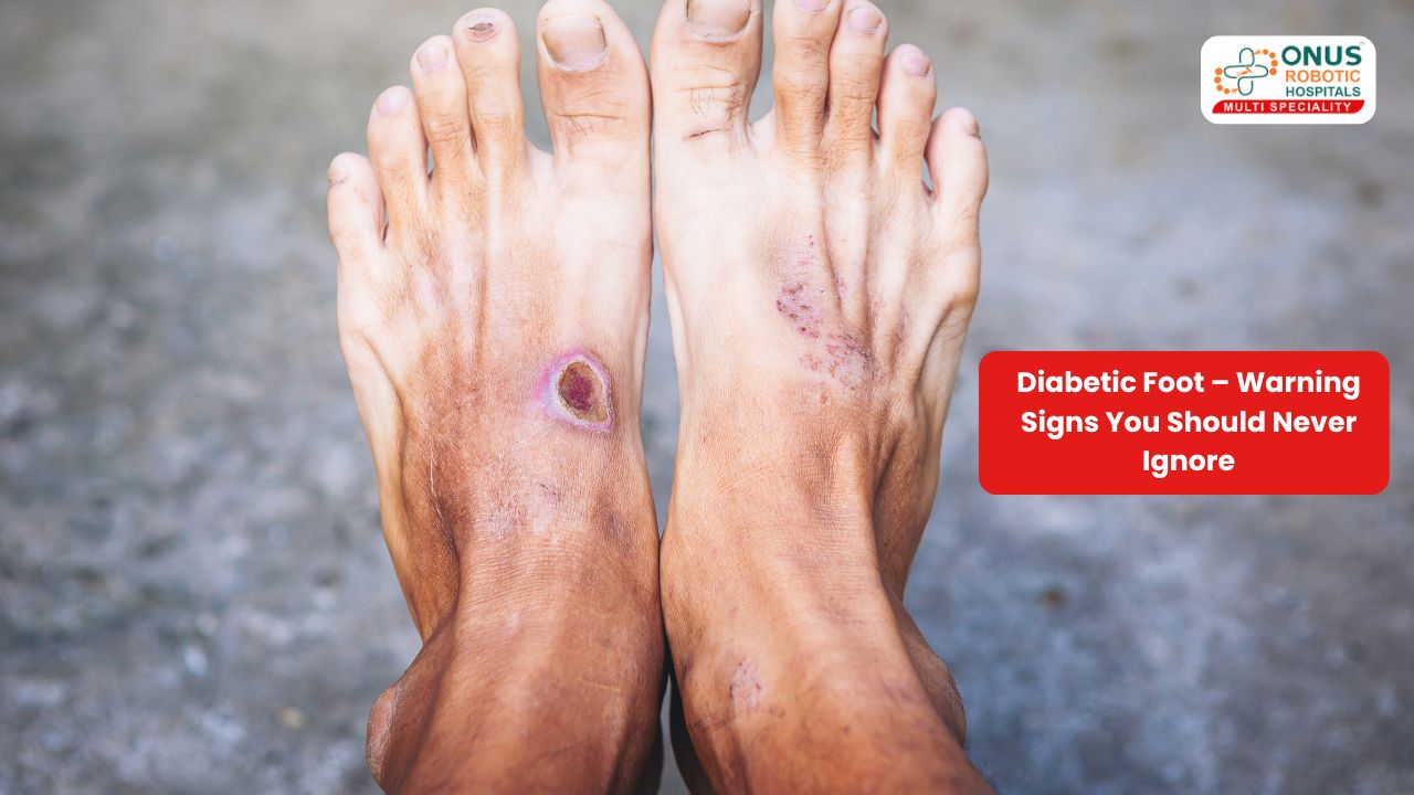 Diabetic Foot – Warning Signs You Should Never Ignore – By Dr. Balaraju Naidu, Robotic Orthopedic Surgeon, ONUS Robotic Hospitals