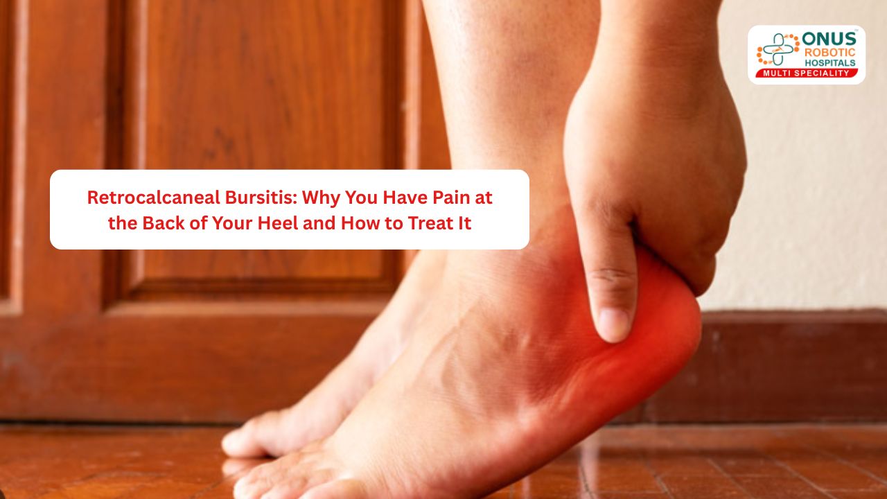 Retrocalcaneal Bursitis: Why You Have Pain at the Back of Your Heel and How to Treat It- By Dr. Balaraju Naidu, Robotic Orthopedic Surgeon, ONUS Robotic Hospitals