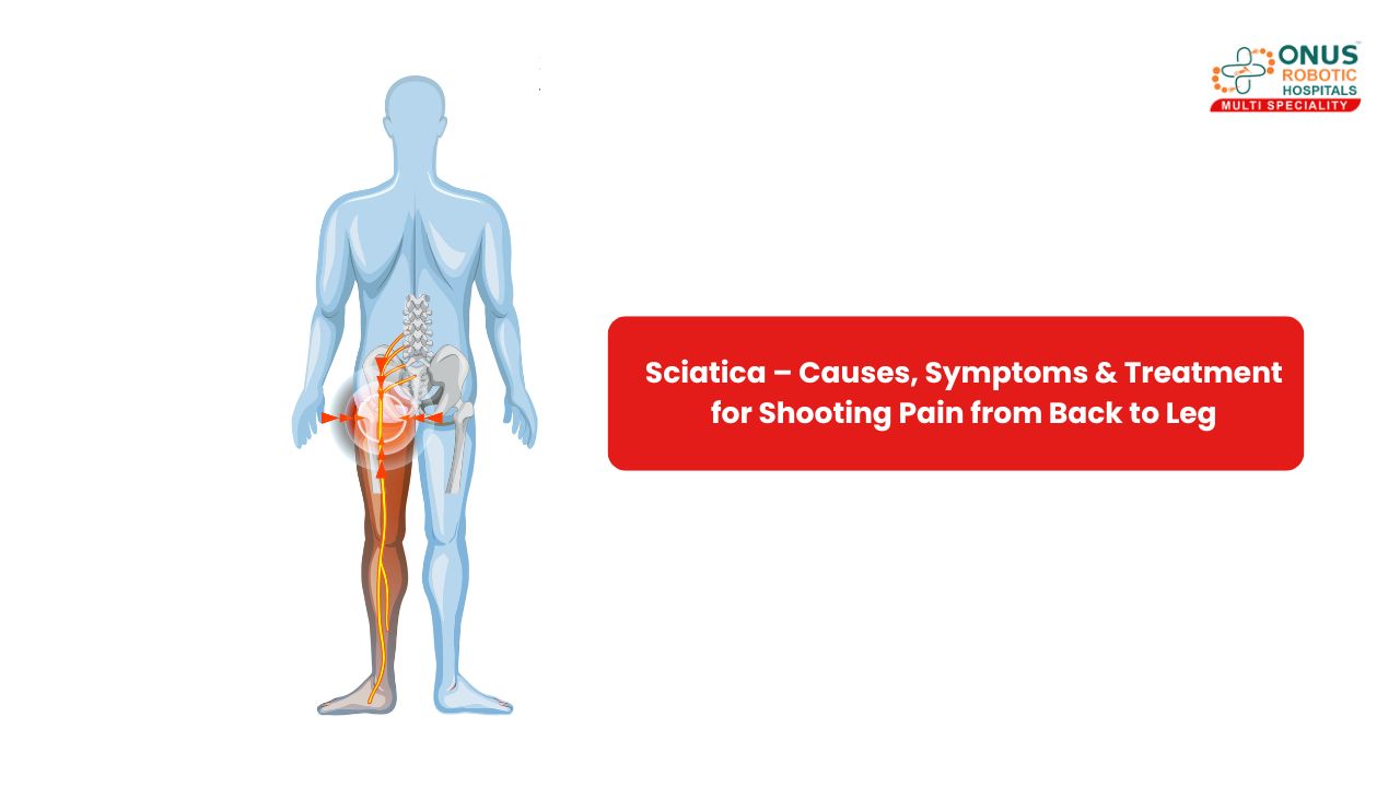 Sciatica – Causes, Symptoms & Treatment for Shooting Pain from Back to Leg – By Dr. Balaraju Naidu, Robotic Orthopedic Surgeon, ONUS Robotic Hospitals