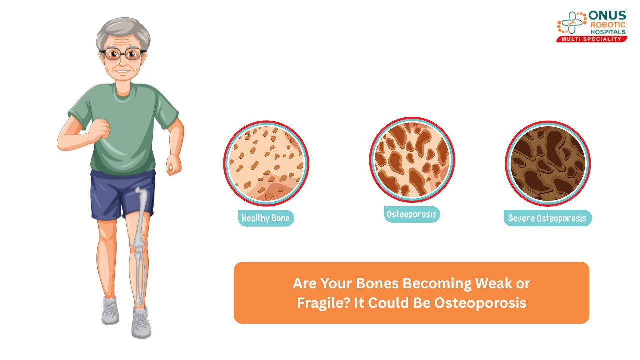 Are Your Bones Becoming Weak or Fragile? It Could Be Osteoporosis- By Dr. Balaraju Naidu, Robotic Orthopedic Surgeon, ONUS Robotic Hospitals