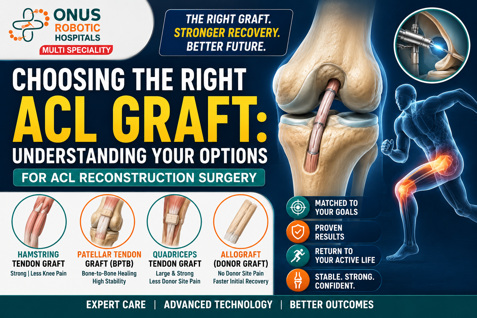 Choosing the Right ACL Graft: Understanding Your Options for ACL Reconstruction Surgery- By Dr. K. Sai Prajwal Reddy, Consultant Arthroscopy, ONUS Robotic Hospitals