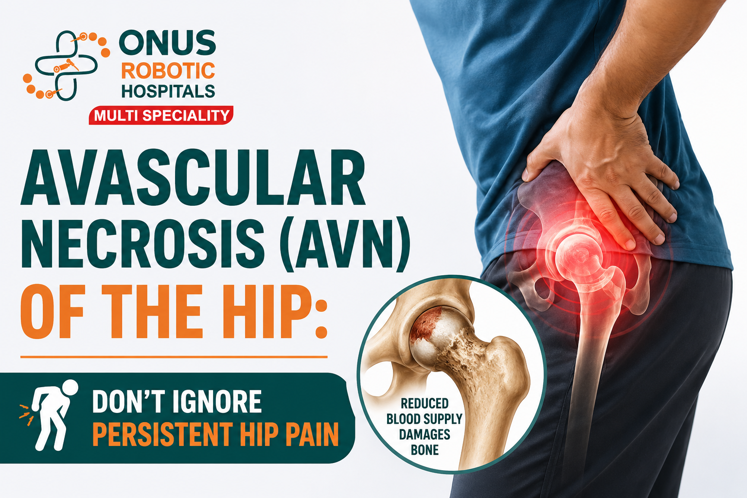 Avascular Necrosis (AVN) of the Hip: Don’t Ignore Persistent Hip Pain- By Dr. Balaraju Naidu, Robotic Orthopedic Surgeon, ONUS Robotic Hospitals
