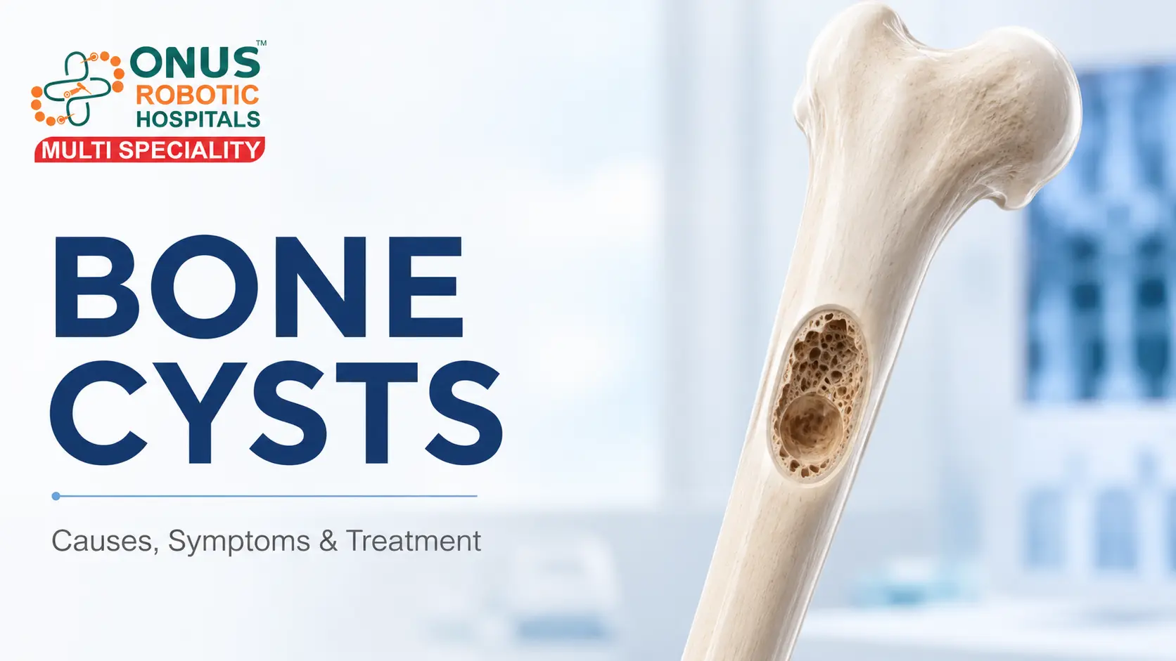 Bone Cysts: Types, Symptoms, Diagnosis & Treatment Options- By Dr. Balaraju Naidu, Robotic Orthopedic Surgeon, ONUS Robotic Hospitals