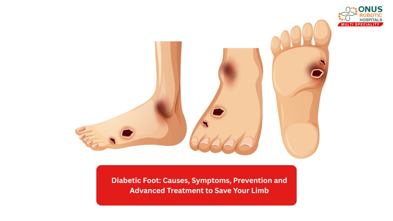Diabetic Foot: Causes, Symptoms, Prevention and Advanced Treatment to Save Your Limb- By Dr. Balaraju Naidu, Robotic Orthopedic Surgeon, ONUS Robotic Hospitals