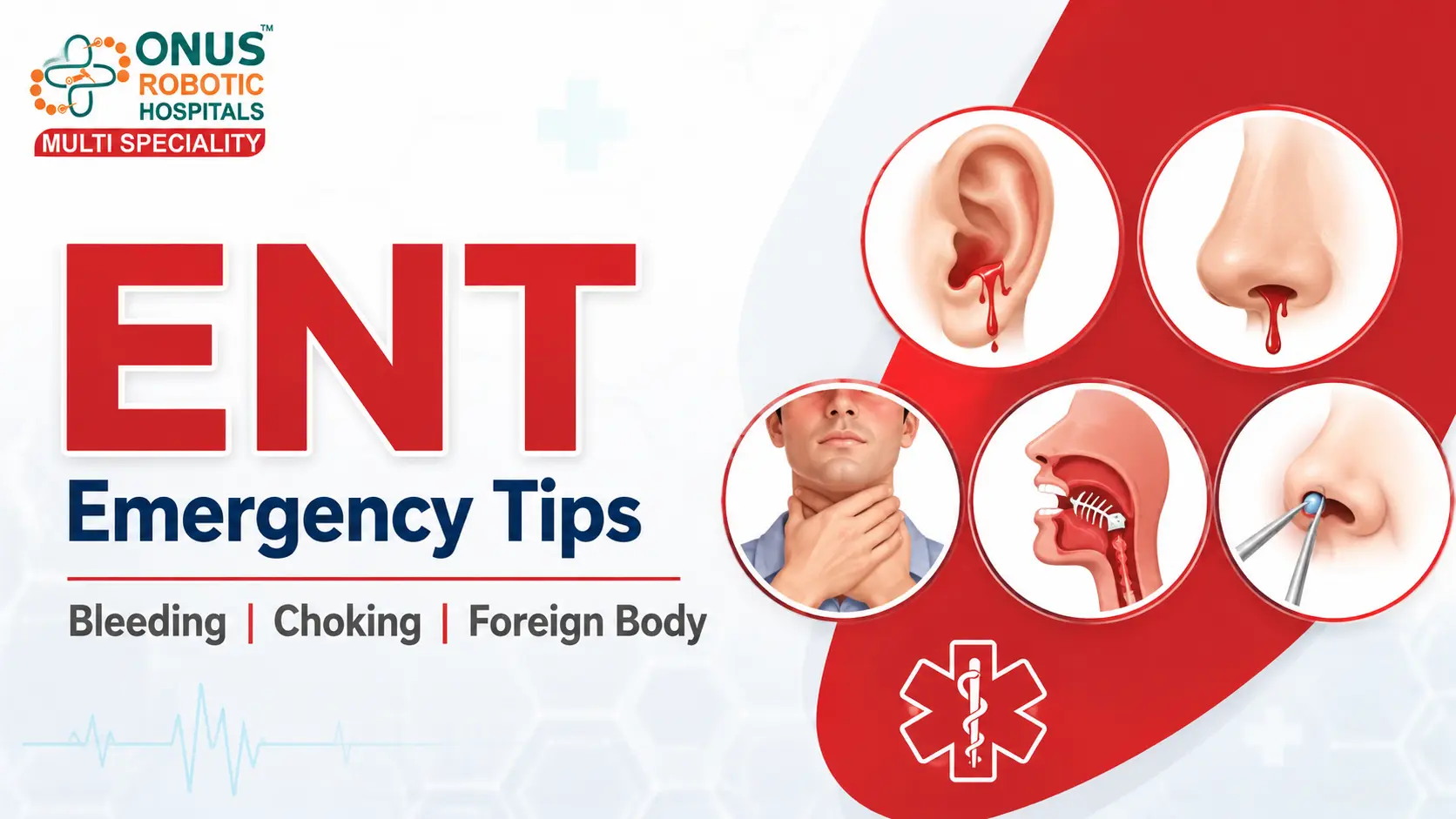 ENT Emergency First Aid Tips: What to Do Before Reaching the Hospital- By Dr. Akshitha Reddy, ENT Specialist, ONUS Robotic Hospitals