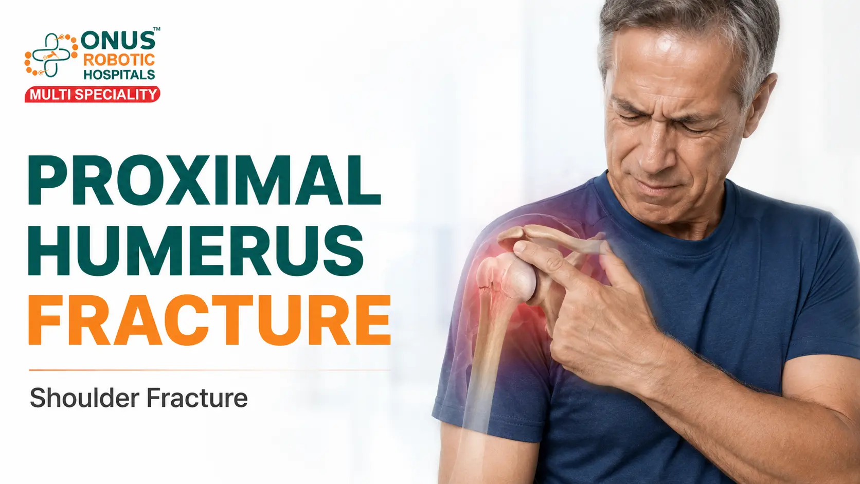 Proximal Humerus Fracture: Causes, Symptoms, Diagnosis & Treatment- By Dr. Balaraju Naidu, Robotic Orthopedic Surgeon, ONUS Robotic Hospitals