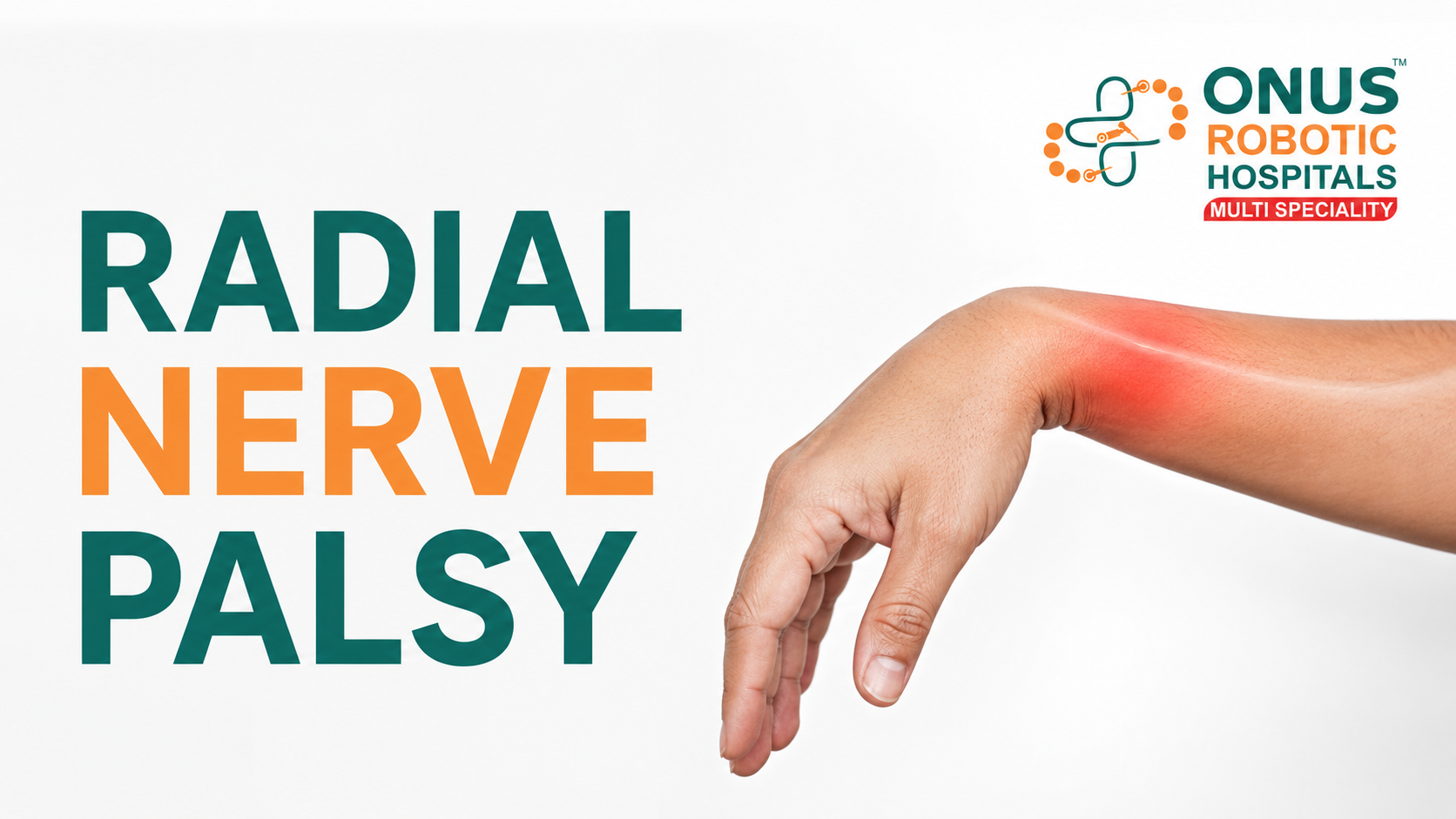 Radial Nerve Palsy: Causes, Symptoms, Diagnosis & Treatment- By Dr. Balaraju Naidu, Robotic Orthopedic Surgeon, ONUS Robotic Hospitals