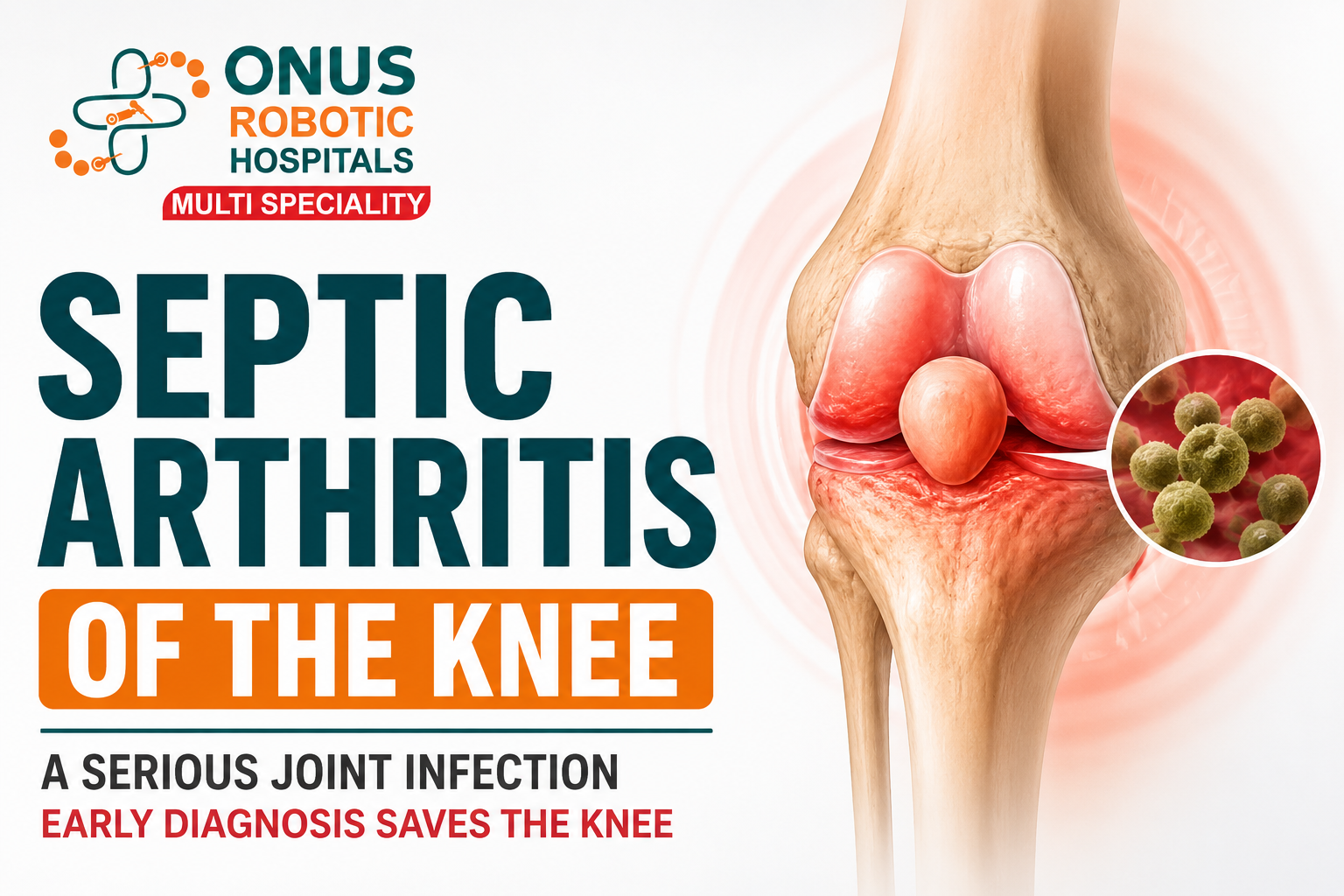 Septic Arthritis of the Knee: Symptoms, Causes & Emergency Treatment- By Dr. Balaraju Naidu, Robotic Orthopedic Surgeon, ONUS Robotic Hospitals