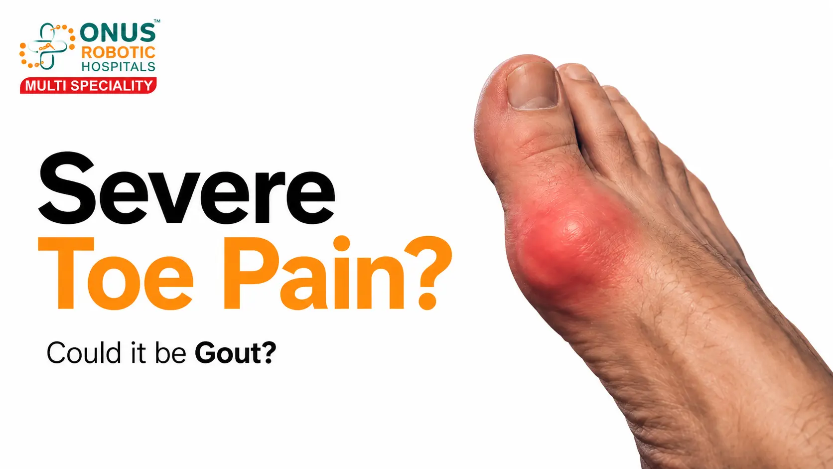 Gout Arthritis: Severe Toe Pain at Night, Causes, Symptoms & Treatment- By Dr. Balaraju Naidu, Robotic Orthopedic Surgeon, ONUS Robotic Hospitals