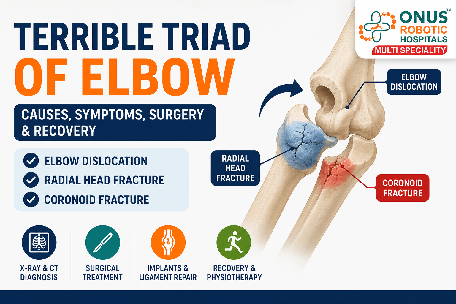 Terrible Triad of Elbow: Causes, Symptoms, Surgery & Recovery- By Dr. Balaraju Naidu, Robotic Orthopedic Surgeon, ONUS Robotic Hospitals