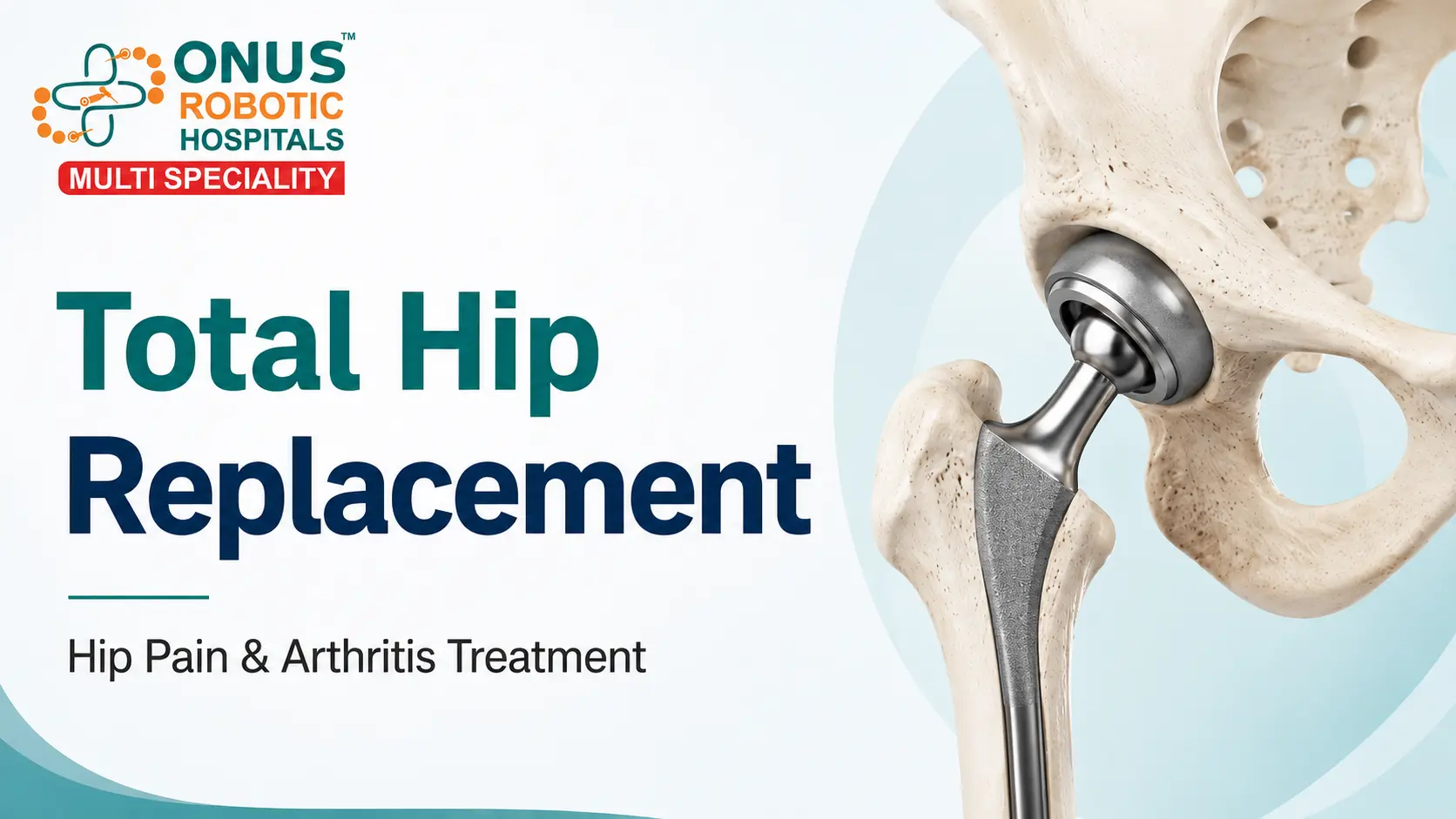 Total Hip Replacement Surgery: Hip Pain & Hip Arthritis Treatment- By Dr. Balaraju Naidu, Robotic Orthopedic Surgeon, ONUS Robotic Hospitals