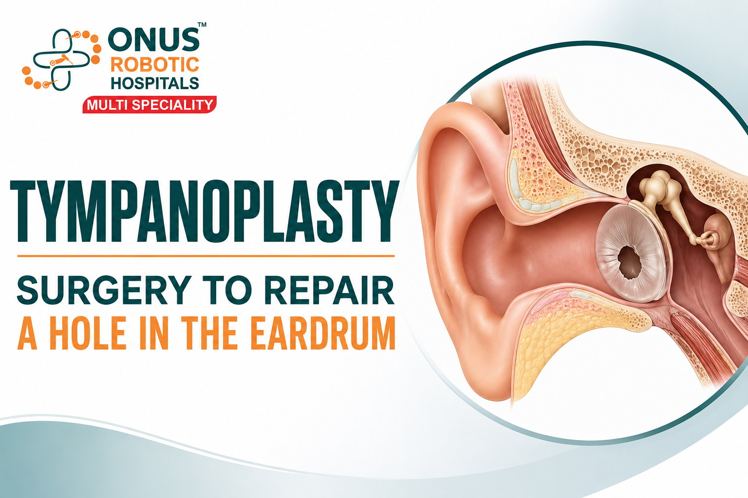 Tympanoplasty: Safe & Effective Surgery to Repair a Hole in the Eardrum- By Dr. Akshitha Reddy, ENT Specialist, ONUS Robotic Hospitals