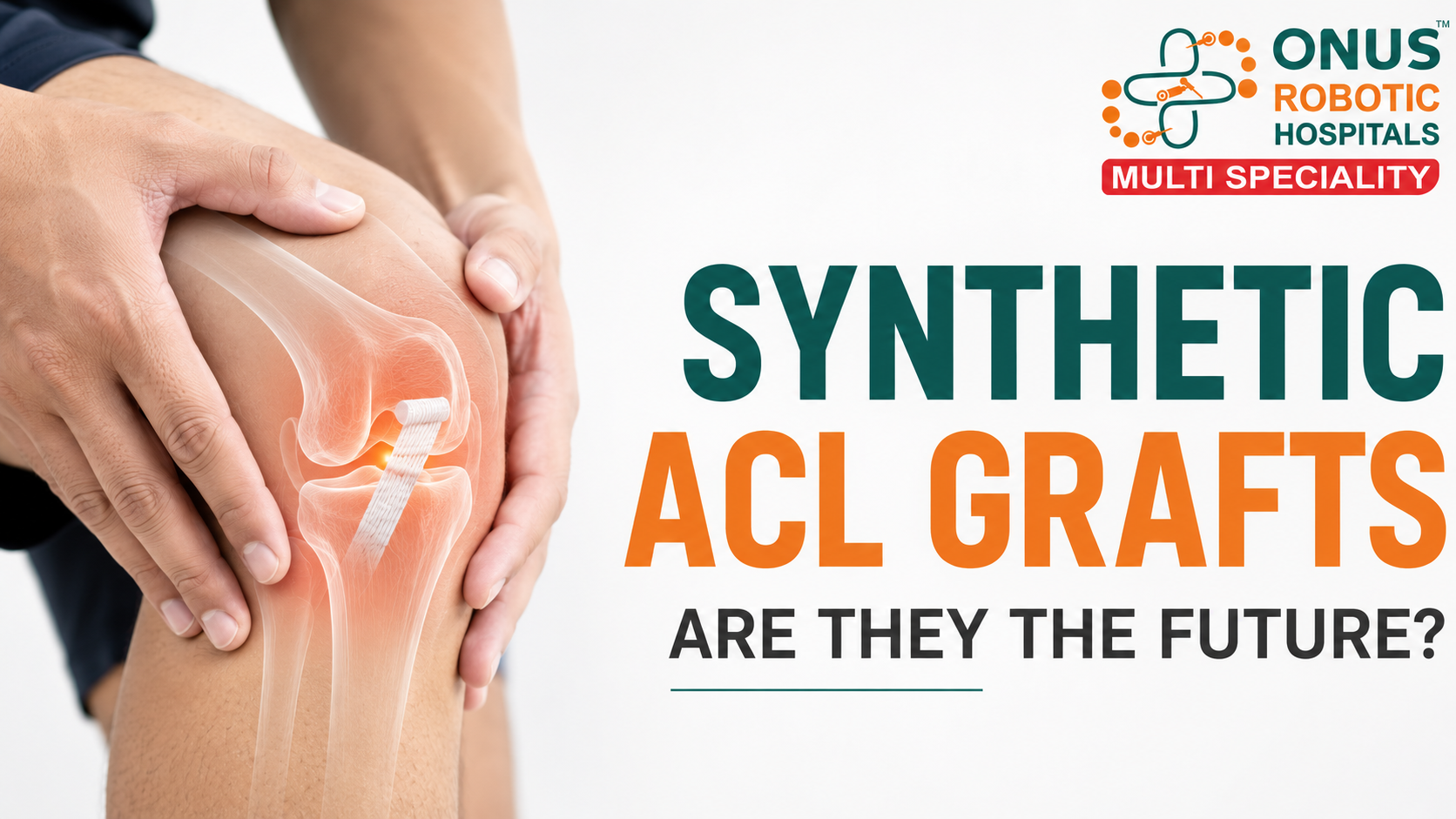 Synthetic ACL Grafts: Are They the Future?- By Dr. K. Sai Prajwal Reddy, Consultant Arthroscopy, ONUS Robotic Hospitals