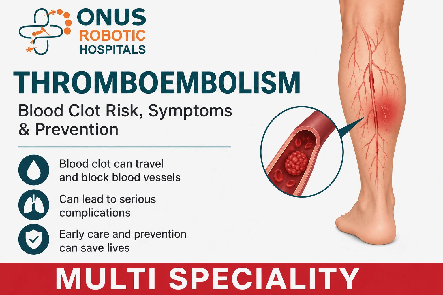Thromboembolism: Understanding Blood Clot Risks, Symptoms, and Prevention – By Dr. Balaraju Naidu, Robotic Orthopedic Surgeon, ONUS Robotic Hospitals