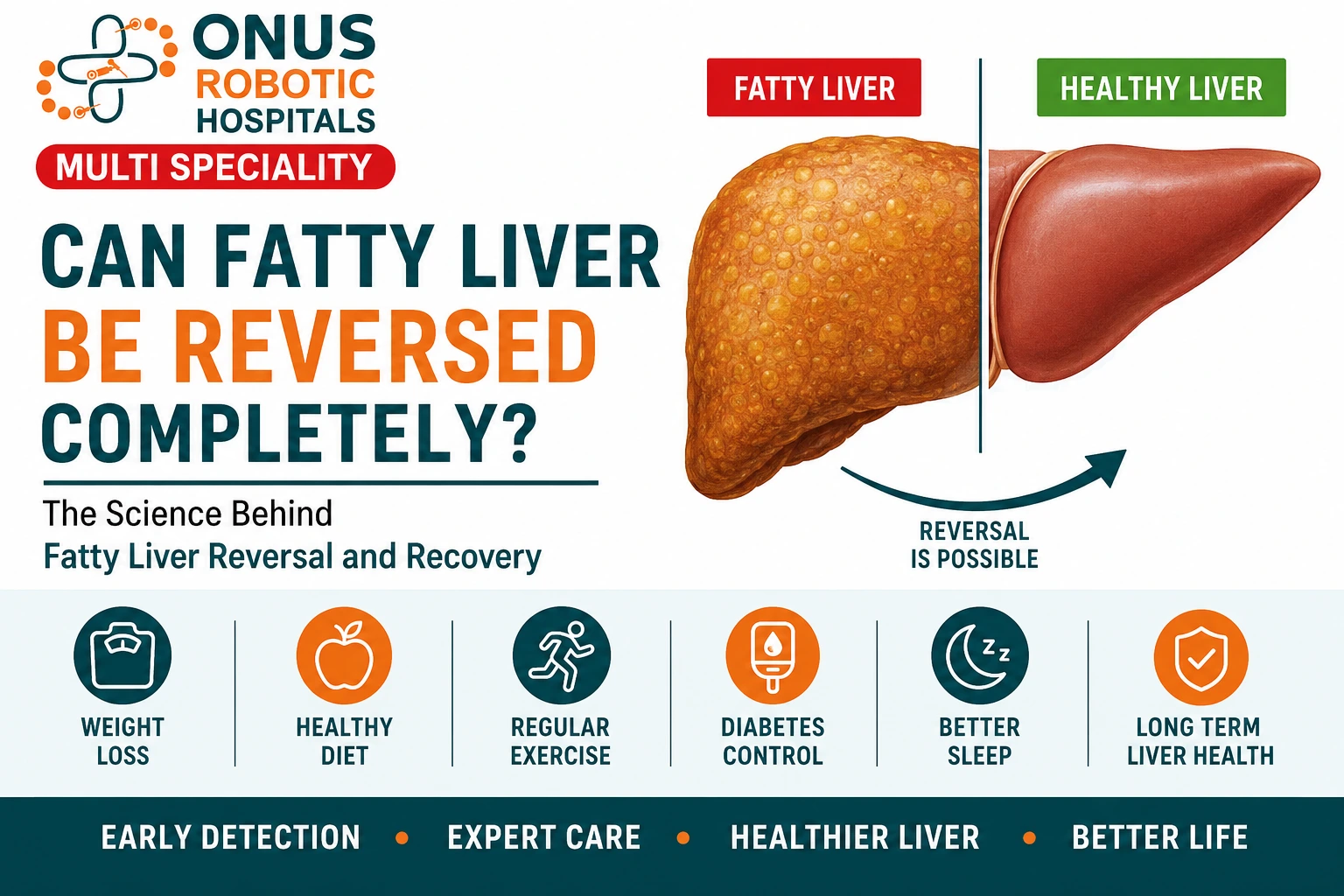 Can Fatty Liver Be Reversed Completely? The Science Behind Fatty Liver Reversal and Recovery: Dr. Ravi Kiran | Diabetologist, Onus Robotic Hospital