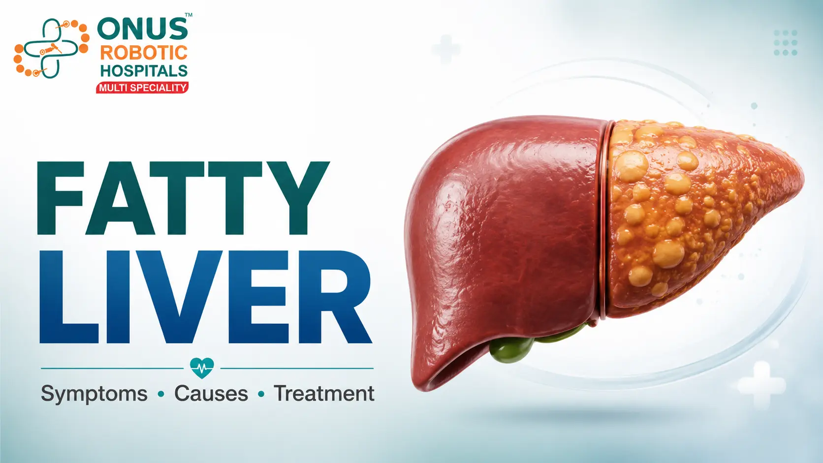 What Is Fatty Liver Disease? Symptoms, Causes, and Fatty Liver Treatment Options: Dr. Ravi Kiran | Diabetologist, Onus Robotic Hospital