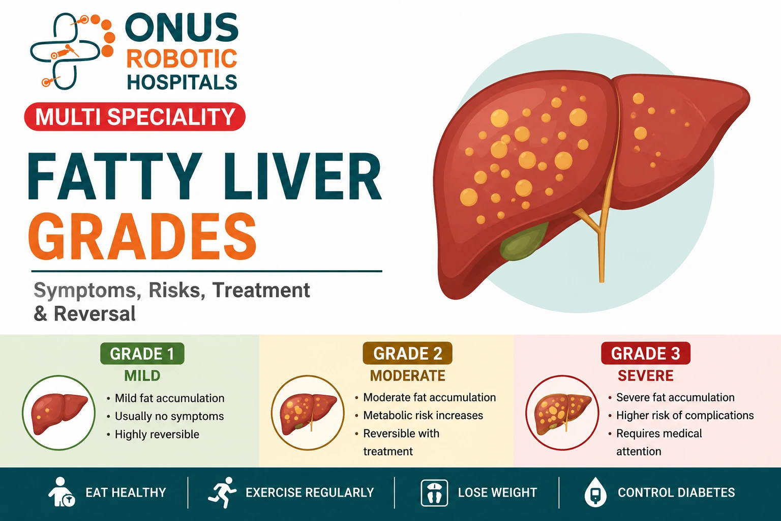 Grade 1, Grade 2 & Grade 3 Fatty Liver Explained: Symptoms, Risks, Treatment & Reversal – By  Dr. Ravi Kiran | Diabetologist, Onus Robotic Hospital