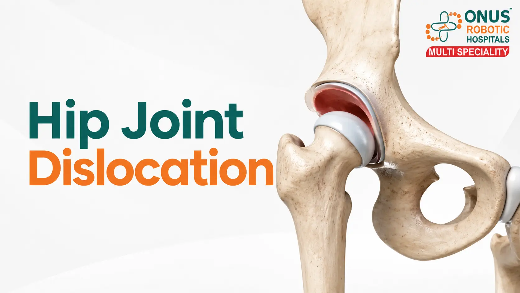 Hip Joint Dislocation: Causes, Emergency Treatment, Complications & Recovery- By Dr. Balaraju Naidu, Robotic Orthopedic Surgeon, ONUS Robotic Hospitals