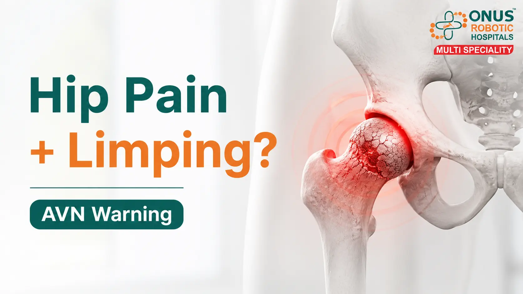 AVN Hip: Why Hip Pain and Limping Should Not Be Ignored- By Dr. Balaraju Naidu, Robotic Orthopedic Surgeon, ONUS Robotic Hospitals