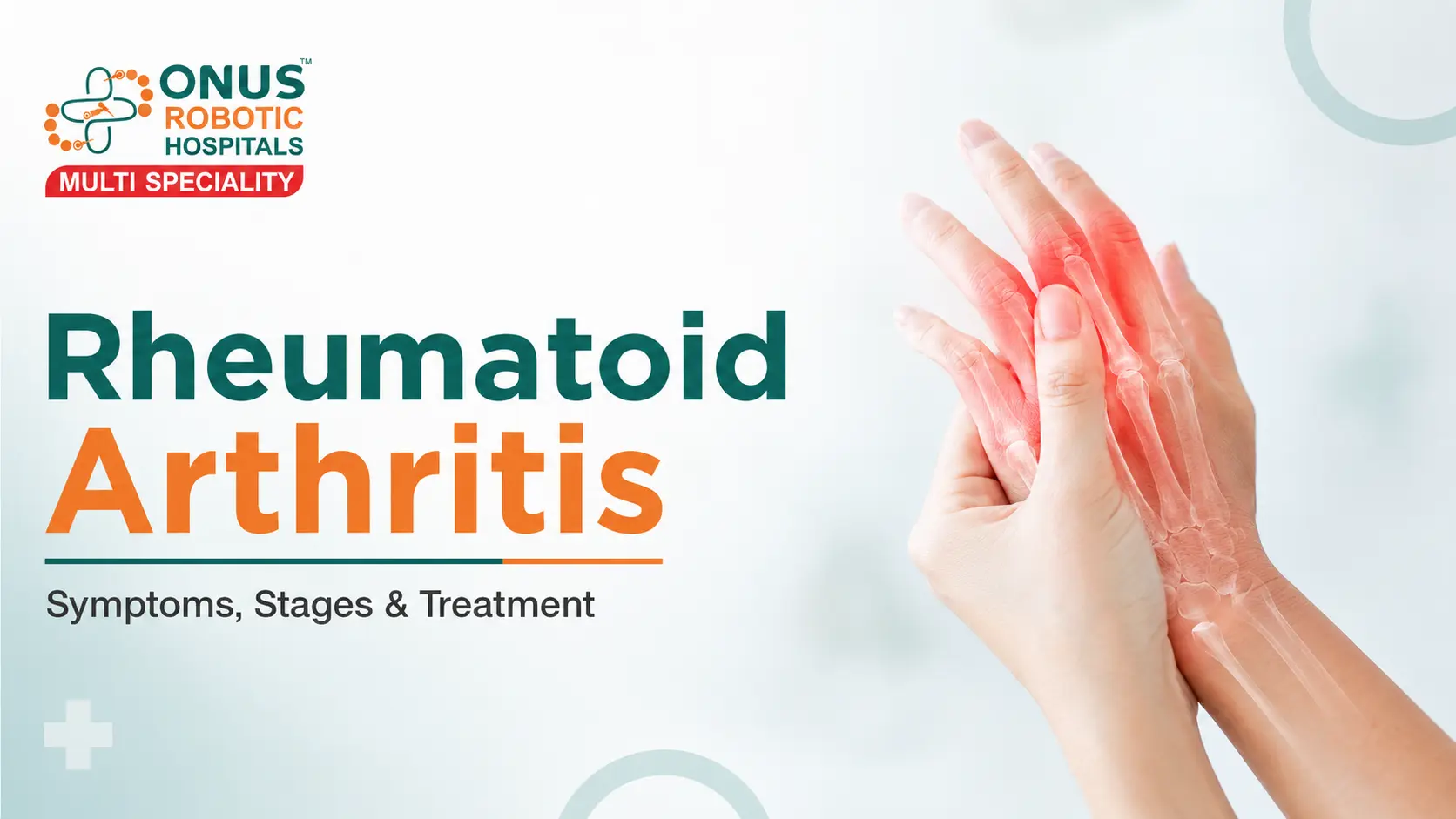 Rheumatoid Arthritis: Symptoms, Stages, Diagnosis & Treatment- By Dr. Balaraju Naidu, Robotic Orthopedic Surgeon, ONUS Robotic Hospitals