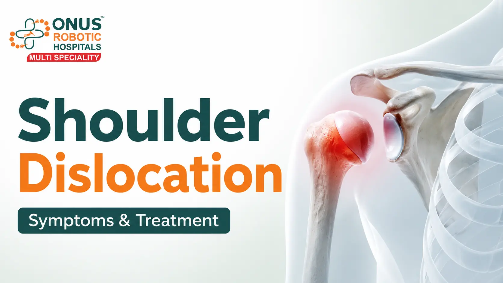 Shoulder Dislocation: Causes, Symptoms, Treatment & Recovery- By Dr. Balaraju Naidu, Robotic Orthopedic Surgeon, ONUS Robotic Hospitals