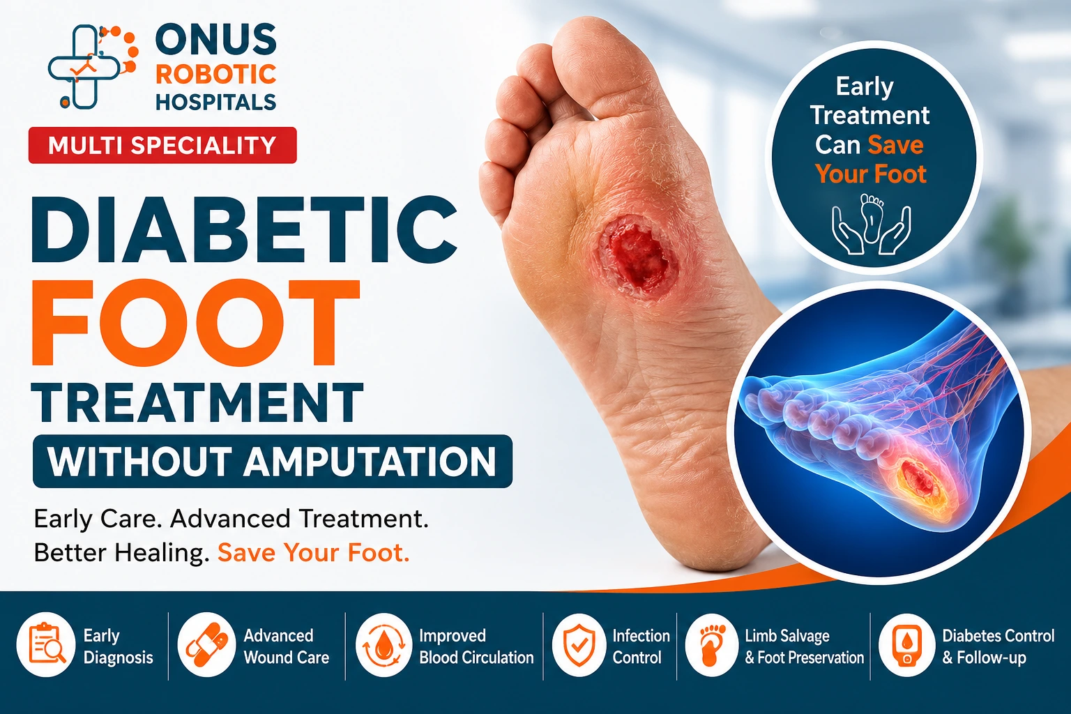 Diabetic Foot Treatment Without Amputation: Early Care Can Help Save Your Foot- By Dr. Balaraju Naidu, Robotic Orthopedic Surgeon, ONUS Robotic Hospitals