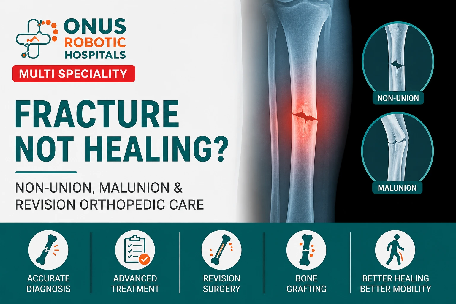Fracture Not Healing? Understanding Non-Union, Malunion & Revision Orthopedic Care- By Dr. Balaraju Naidu, Robotic Orthopedic Surgeon, ONUS Robotic Hospitals
