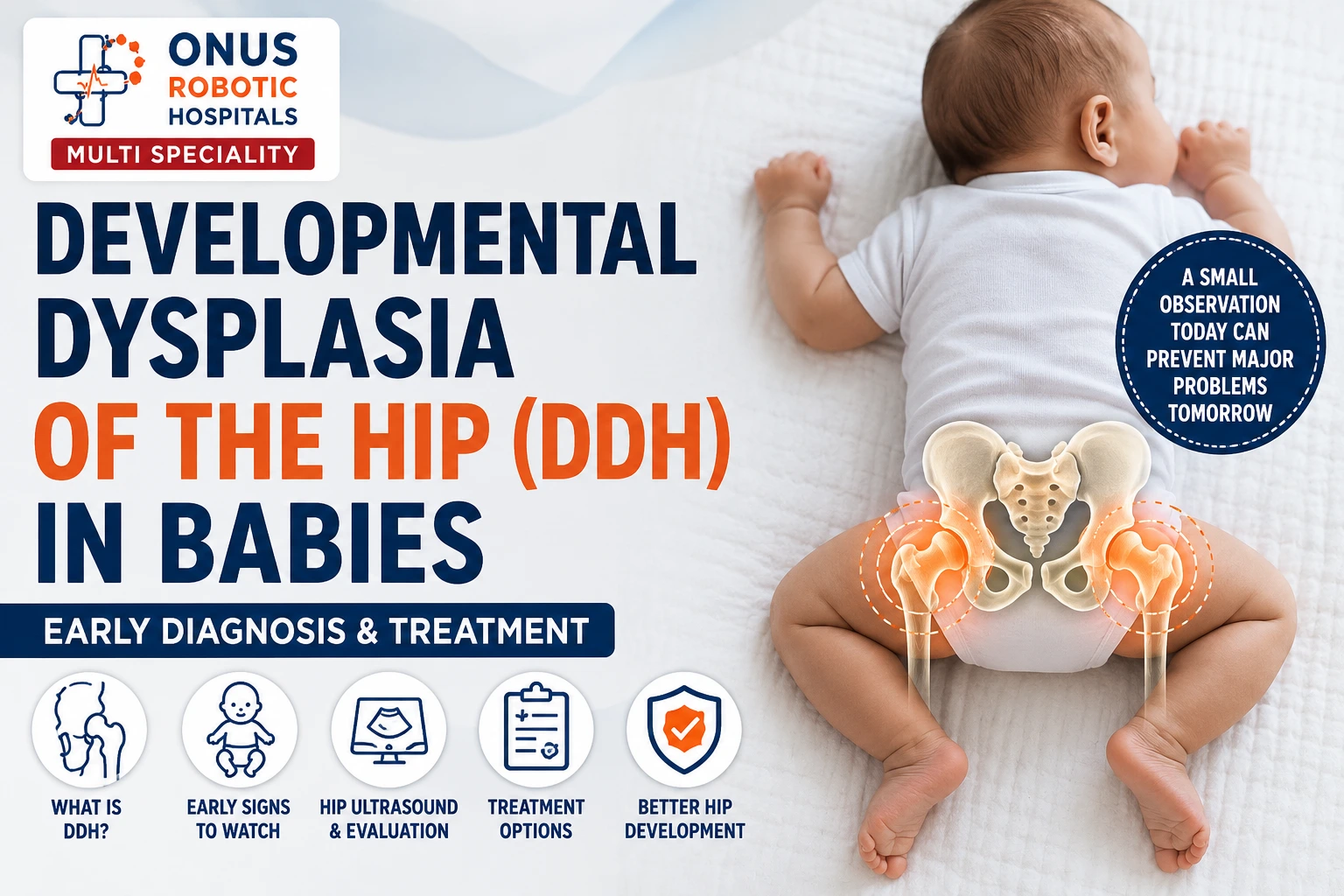 Developmental Dysplasia of the Hip (DDH) in Babies: Why Early Diagnosis Matters- By Dr. Balaraju Naidu, Robotic Orthopedic Surgeon, ONUS Robotic Hospitals