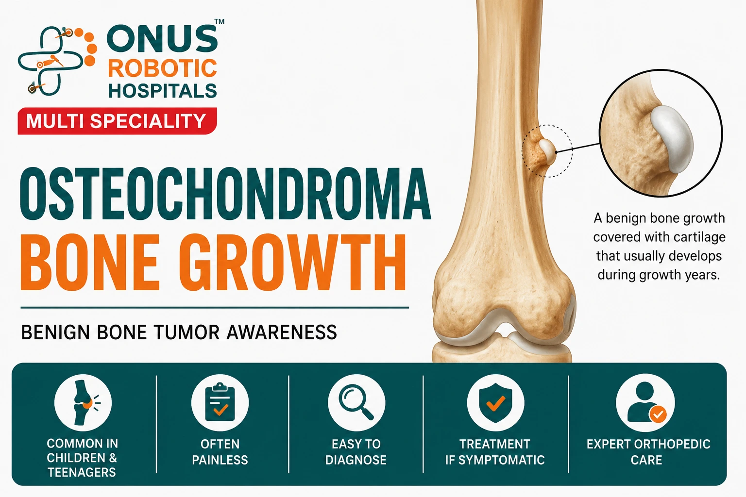 Osteochondroma (Benign Bone Growth): Symptoms, Causes, Diagnosis & Treatment- By Dr. Balaraju Naidu, Robotic Orthopedic Surgeon, ONUS Robotic Hospitals