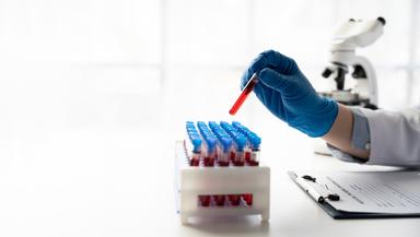 Gastro Health Check-up