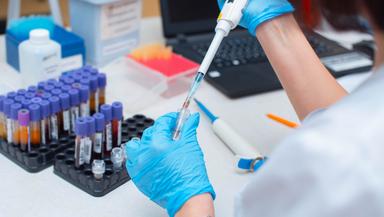 Diabetic Check-up