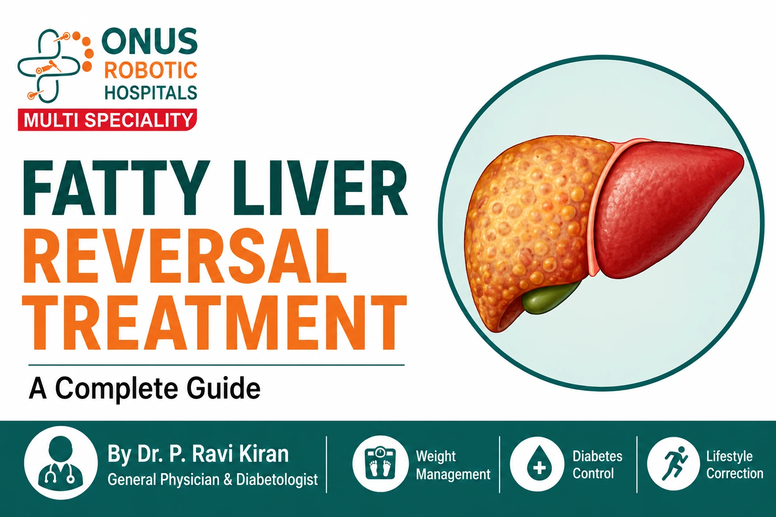 Fatty Liver Reversal Treatment: A Complete Guide – By  Dr. Ravi Kiran | Diabetologist, Onus Robotic Hospital
