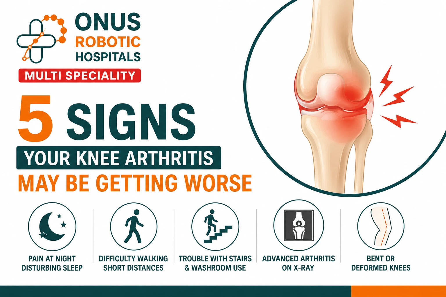 5 Signs Your Knee Arthritis May Be Getting Worse- By Dr. Balaraju Naidu, Robotic Orthopedic Surgeon, ONUS Robotic Hospitals