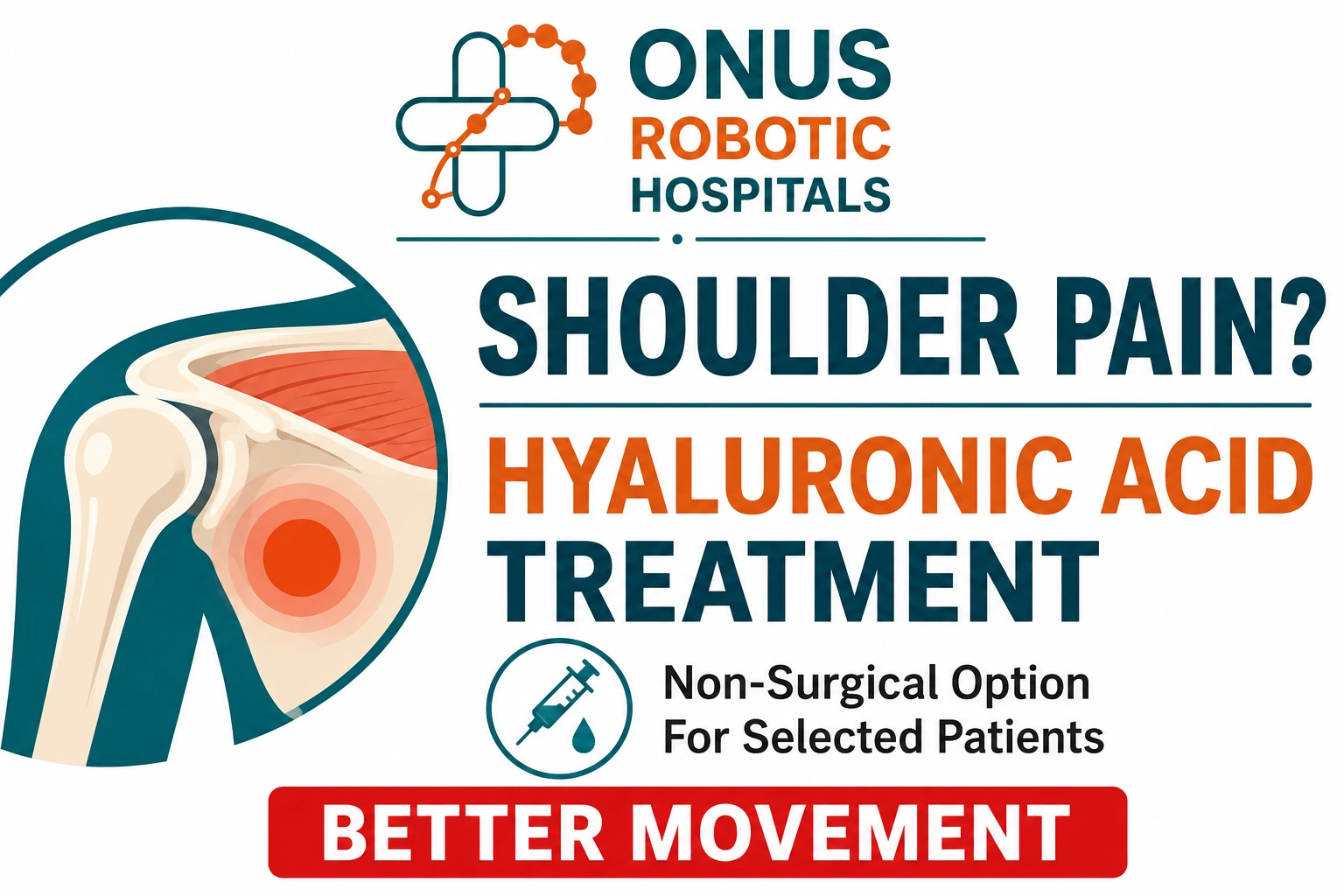 Hyaluronic Acid Treatment for Shoulder Pain: A Non-Surgical Option for Selected Patients- By Dr. Balaraju Naidu, Robotic Orthopedic Surgeon, ONUS Robotic Hospitals