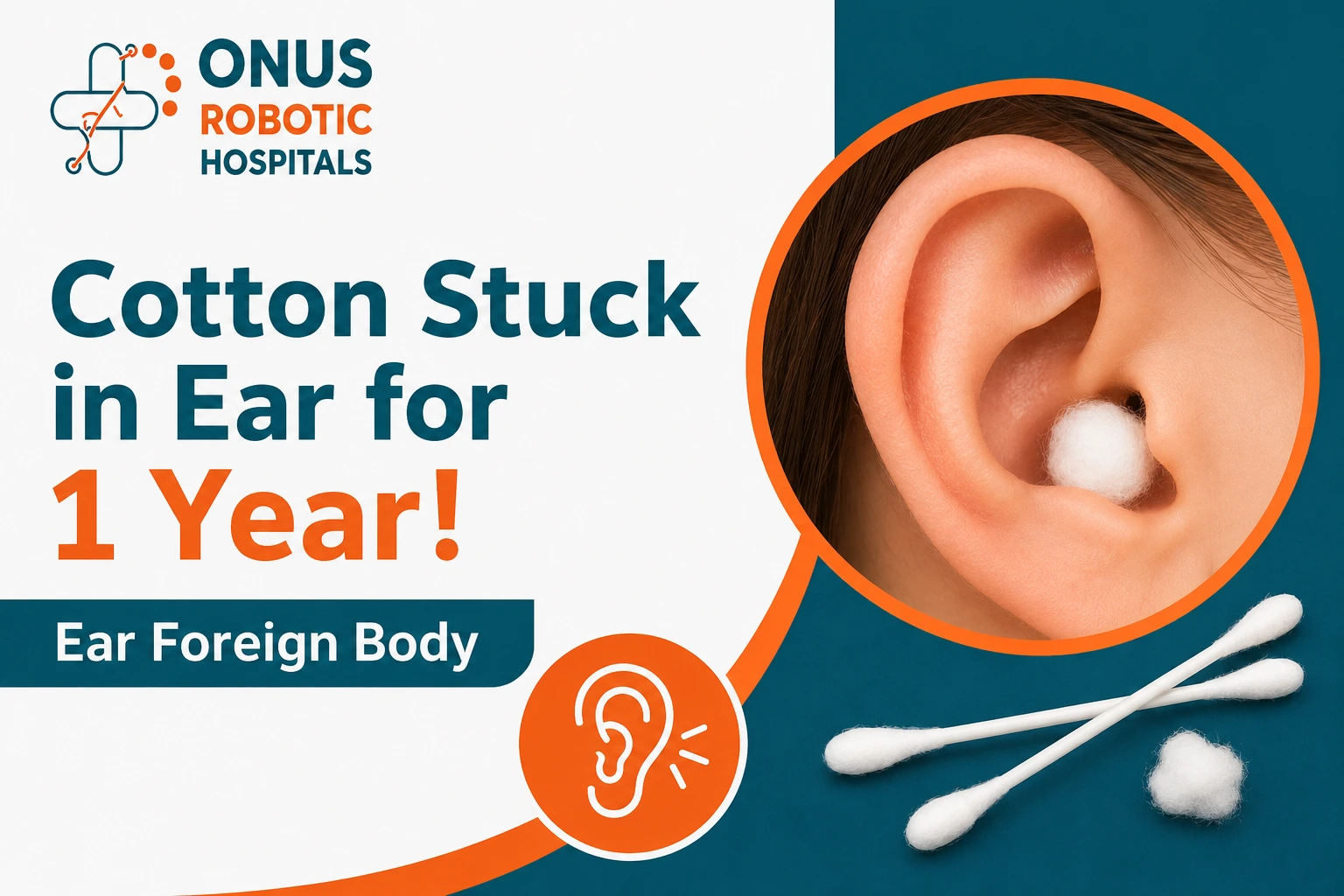 Cotton Stuck in Ear for 1 Year? Understanding Ear Foreign Bodies and When to See an ENT Specialist- By Consultant ENT Head & Neck Surgeon, ONUS Robotic Hospitals