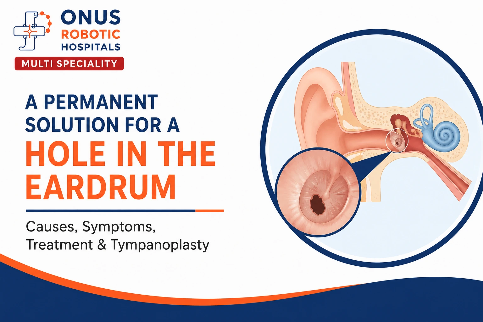 A Permanent Solution for a Hole in the Eardrum: Causes, Symptoms & Tympanoplasty- By Consultant ENT Head & Neck Surgeon, ONUS Robotic Hospitals