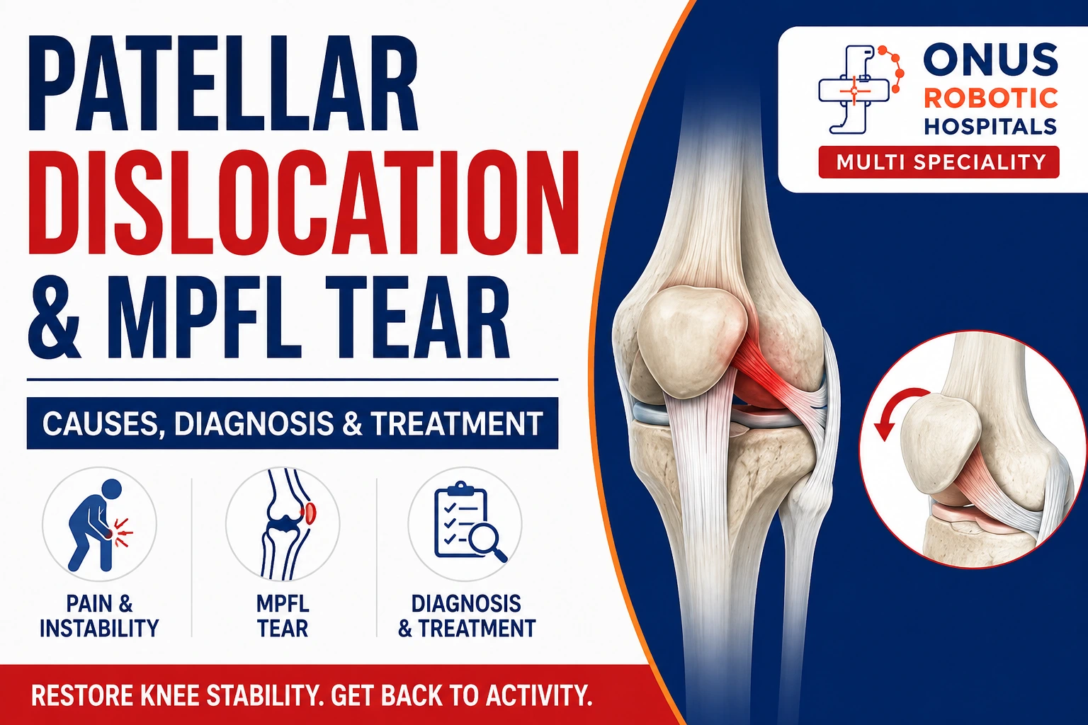 Patellar Dislocation & MPFL Tear: Causes, Symptoms, Diagnosis and Treatment- By Dr. Balaraju Naidu, Robotic Orthopedic Surgeon, ONUS Robotic Hospitals