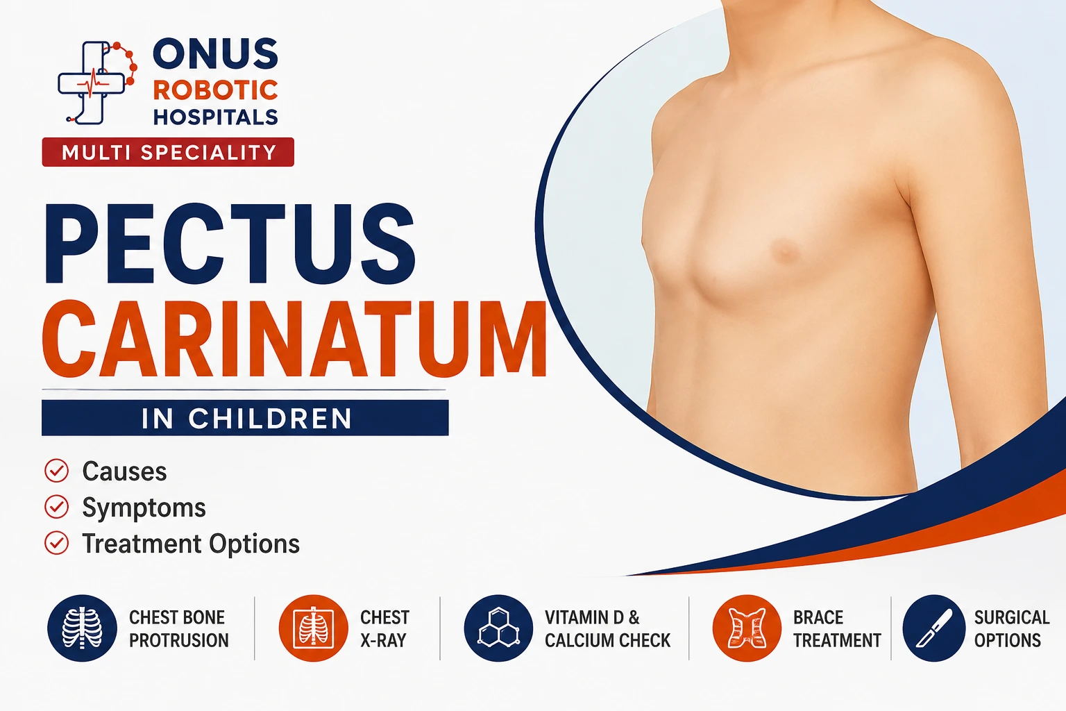 Pectus Carinatum in Children: Causes, Symptoms, Diagnosis & Treatment- By Dr. Balaraju Naidu, Robotic Orthopedic Surgeon, ONUS Robotic Hospitals